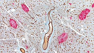 Islets of Langerhans stained red for insulin