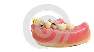 Isolated dental diseases model