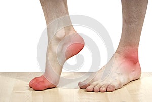 Isolated disease of the feet