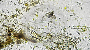 Isolated footage of fresh water sample with pieces of algae and swimming rotifer