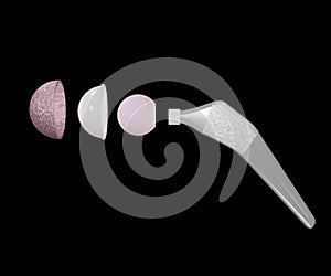 Total hip replacement components and examples of commercial hip stem implant photo