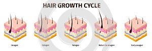 Isometric hair follicle growth cycle steps infographic. Skin anatomy medical poster. Hair grow anagen, telogen, catagen