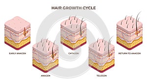 Isometric hair growth cycle, anagen, telogen, catagen phases. Human skin layers with hair follicle growth flat vector illustration