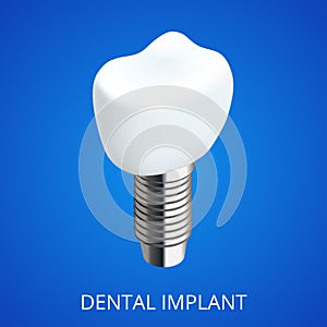 Isometric Tooth human implant. Dental concept. Human teeth or dentures. 3d illustration Isolated