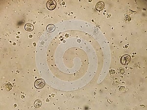 Isospora spp. oocysts from cat`s  faeces under the microscope photo