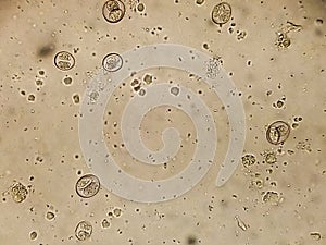 Isospora spp. oocysts from cat`s  faeces under the microscope