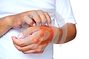 Itching of skin diseases in men using the hand-scratching. Red around the Itching area