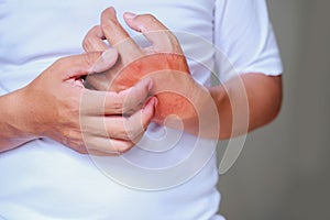 Itching of skin diseases in men using the hand-scratching. Red around the Itching area