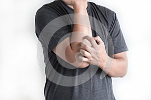 Itchy arms scratching Healthcare And Medicine Health problem photo