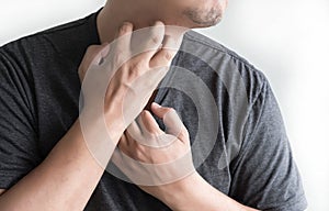 Itchy arms scratching Healthcare And Medicine Health problem