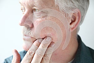 Itchy rash on man's face photo