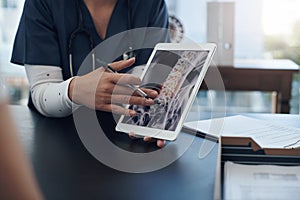 Its better to explain this with an image. an unrecognizable doctor showing a patient a digital x-ray in an office.