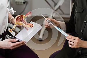 IUD intrauterine device and uterus model in hands. Gynecology consultation.