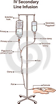 IV Secondary Line Infusion vector illustration