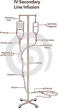 IV Secondary Line Infusion vector illustration photo