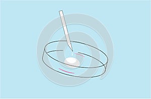 IVF or ICSI Process Vector Illustration