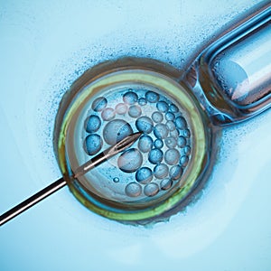 IVF macro concept