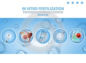 IVF Process Procedures Schematic Explanations. photo