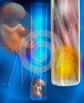 IVF - In vitro fertilisation photo