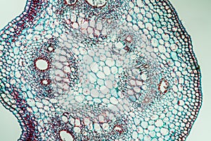 Ivy leaf in cross section