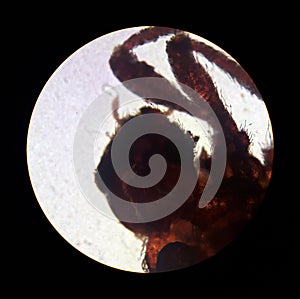 Ixodes tick, view from the microscope. tick in the laboratory