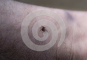 Ixodoidea mite crawls on human skin close up