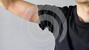 Japanese man's arm with rough skin