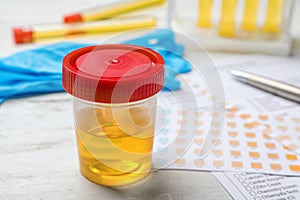 Jar with urine sample on table. Urology concept