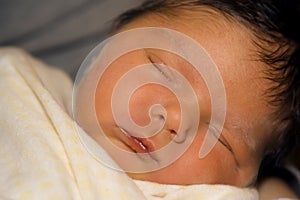 Jaundiced Newborn