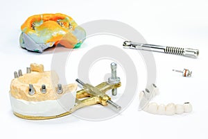 jaw model with dental implants and ceramic crowns. in the background is a dental impression with implantation tools