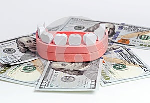 Jaw model with dollar bills. Teeth insurance and cost of tooth treatment, implantation, extraction concept. Money in