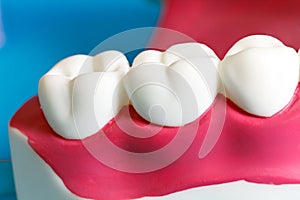 Jaw Model with human teeth