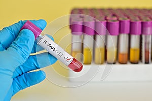 JE virus blood sample
