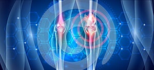 Joint knee problems abstract diagram