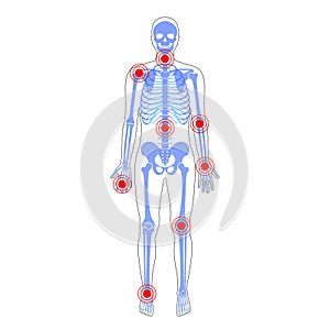 Joint pain on skeleton in human body