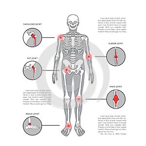 Joint pain vector body parts with pain ring