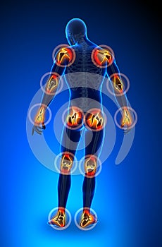 Joints pain - full figure