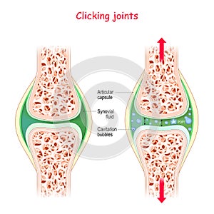 Joints and popping sound. Physiological Mechanism of cavitation photo
