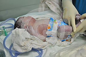 Just born baby photo