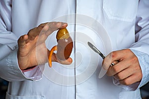 Kidney and adrenal surgery medical surgical photo idea. The doctor holds in one hand a model of a kidney with a ureter, and in the