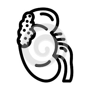 kidney cancer line icon vector illustration