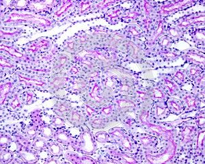 Kidney. Convoluted tubules. Periodic acidâ€“Schiff PAS method