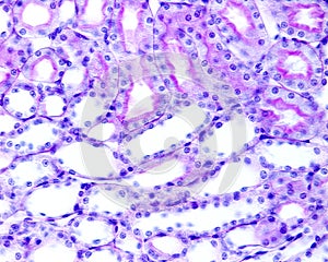 Kidney. Convoluted tubules. Periodic acidâ€“Schiff PAS method