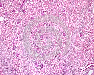 Kidney cortex. Medullary rays