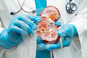 Kidney disease, Chronic kidney disease ckd, Doctor hold human model to treat and study in hospital
