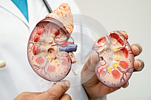 Kidney disease, Chronic kidney disease ckd, Doctor with human model to study and treat in hospital