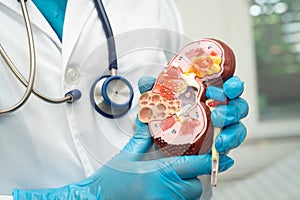 Kidney disease, Chronic kidney disease ckd, Doctor with human model to study and treat in hospital