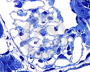 Kidney glomerulus micrograph photo