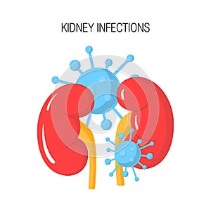 Kidney infection vector concept