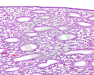 Kidney medulla. Bellini ducts photo